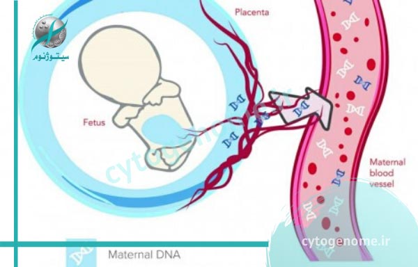 بررسی آزمایش خون مادر از نظر Cell Free Fetal DNA