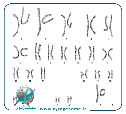 کاریوتایپ خون