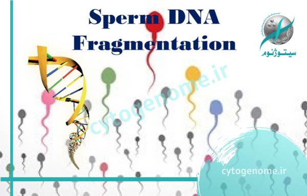 قطعه قطعه شدن DNA اسپرم یا SDF