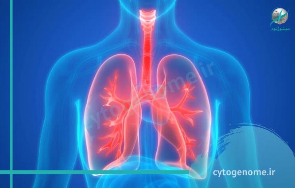مشاوره ژنتیک در اختلالات تنفسی