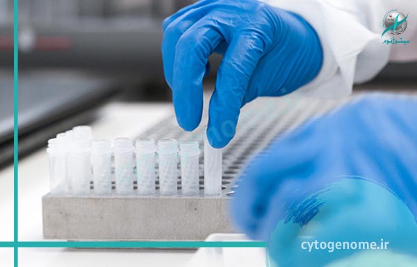 آزمایش ARMS- PCR