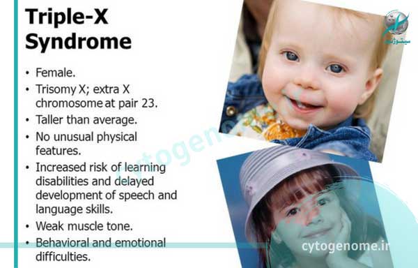 تریزومی کروموزوم ایکس چیست؟