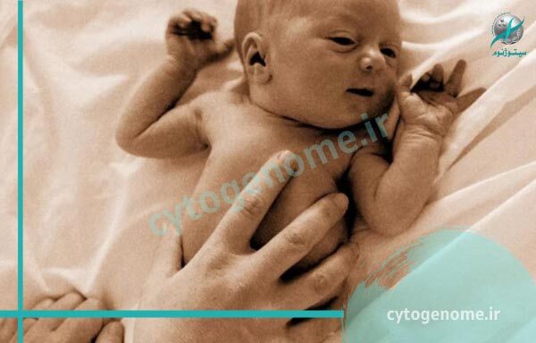 هایپرپلازی مادرزادی آدرنال چیست