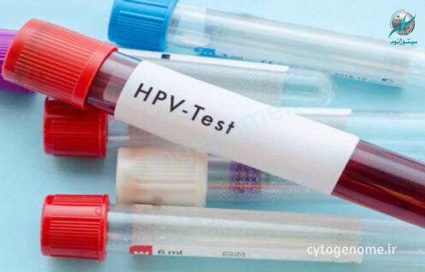 تفسیر آزمایش HPV چگونه است؟