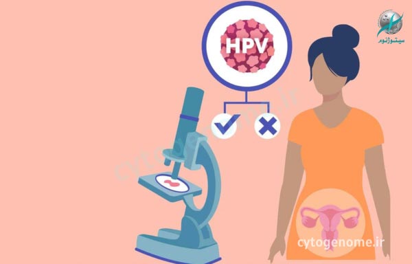 نحوه انجام تست HPV